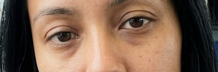 Downturned eyes, shown on one of our models