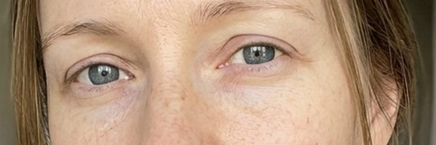 Hooded eyes, shown on one of our models